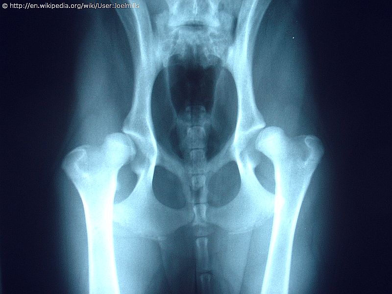 Röntgenbild schwere HD – flache Pfanne und deformierter Kopf